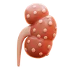 kidney failure