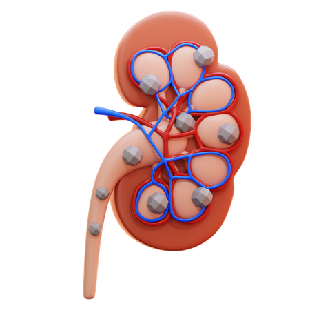 Kidney stones  3D Icon