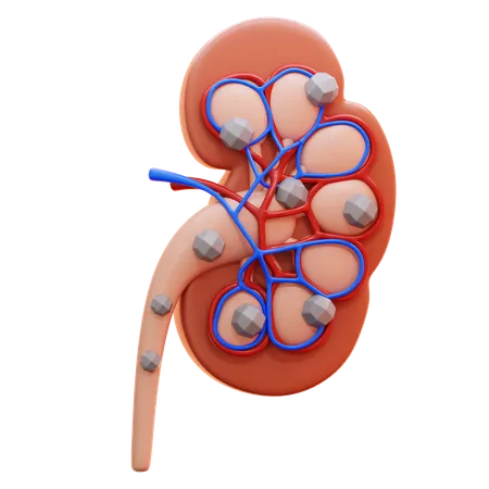 Kidney stones  3D Icon