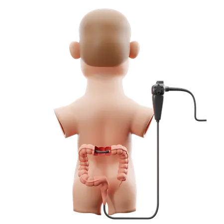 Darmspiegelung (Koloskopie)  3D Icon