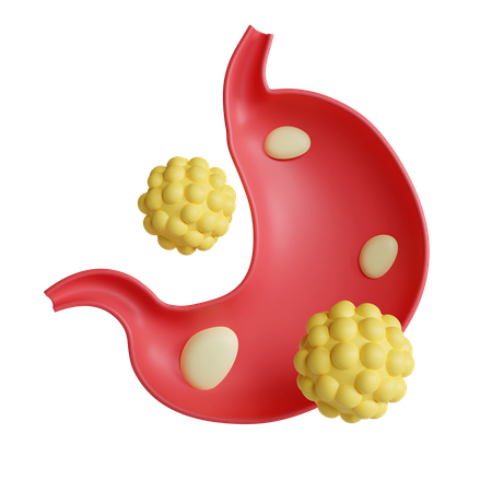 Large intestine cancer  3D Icon