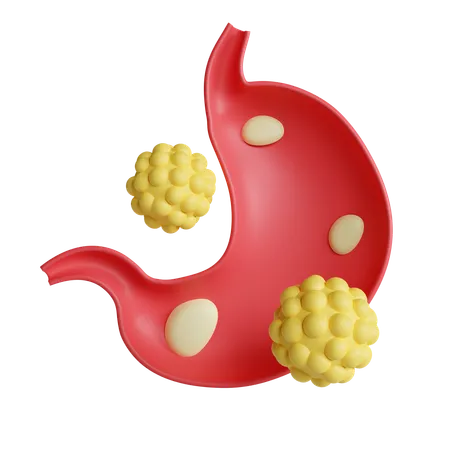 Large intestine cancer  3D Icon