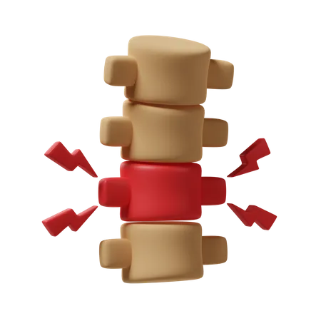 Lesão vertebral  3D Icon