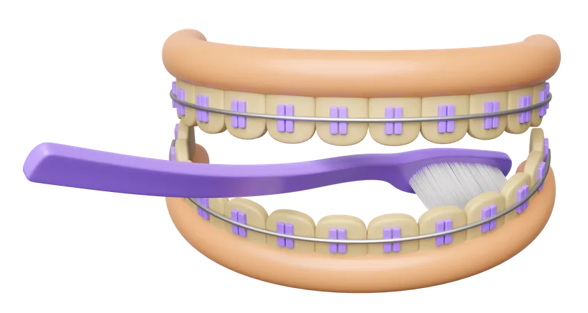 Limpeza dos dentes com aparelho dentário  3D Illustration
