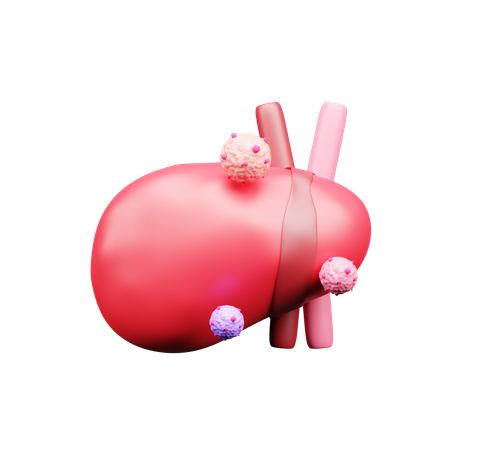 Liver Cancer  3D Icon