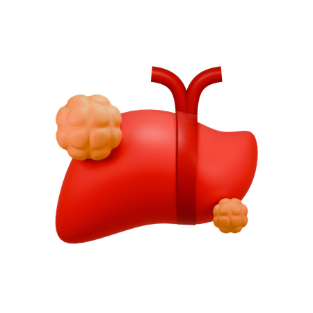 Liver Cancer  3D Icon