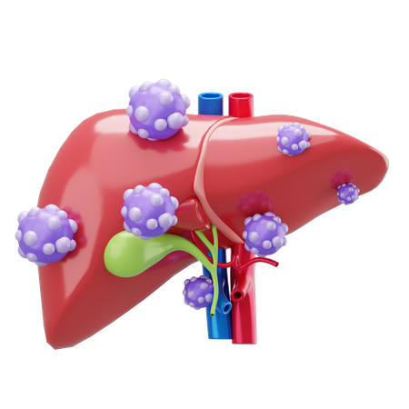 Liver Cancer  3D Icon