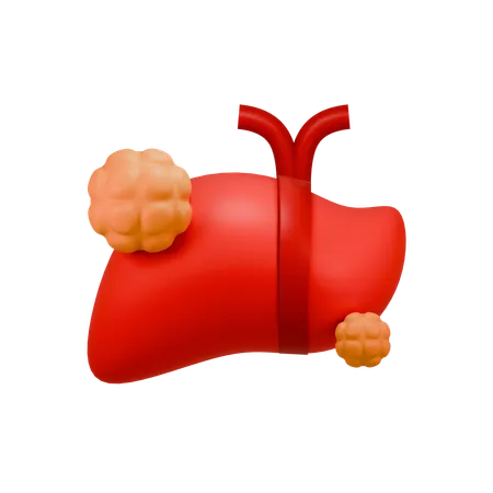 Liver Cancer  3D Icon