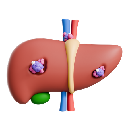 Liver Cancer  3D Icon