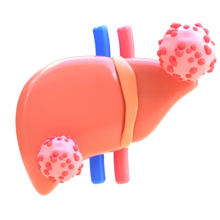 Liver Cancer  3D Icon