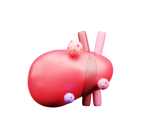 Liver Cancer  3D Icon