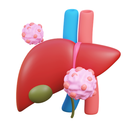 Liver cancer  3D Icon