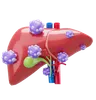 Liver Cancer