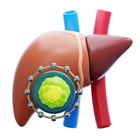 Liver Cancer  3D Icon