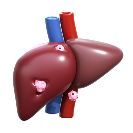 Liver Cancer  3D Icon