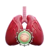 Lung Cancer