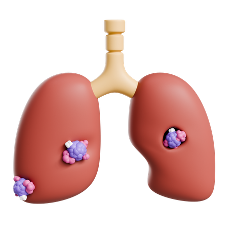 Lung Cancer  3D Icon