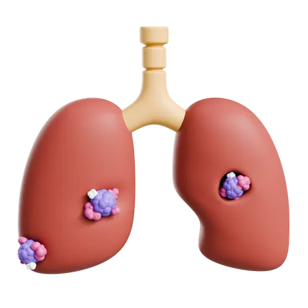 Lung Cancer  3D Icon