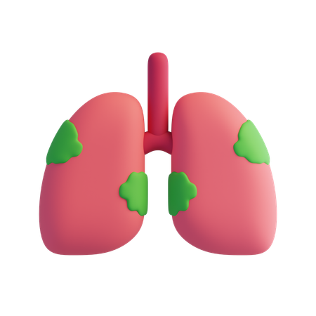 Lung cancer  3D Icon