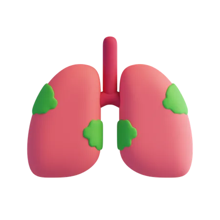 Lung cancer  3D Icon