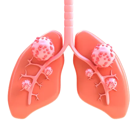 Lung Cancer  3D Icon