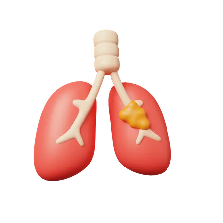 Lung Cancer  3D Icon