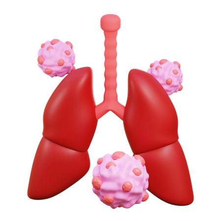 Lung cancer 3D Illustration