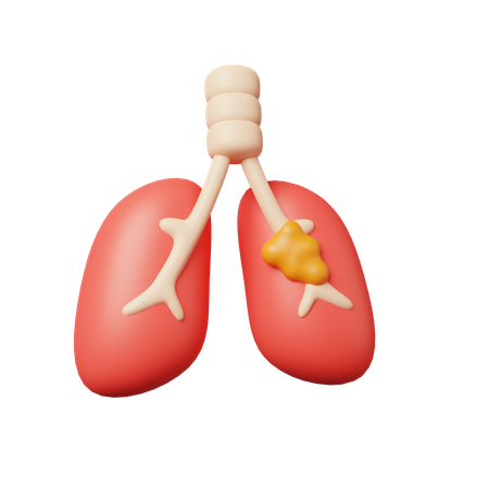 Lung Cancer  3D Icon