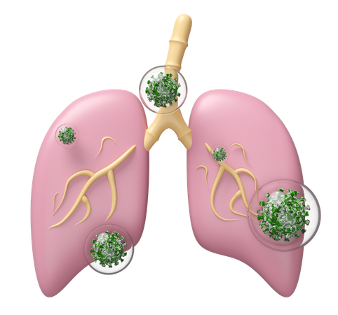 Lung With Virus  3D Icon