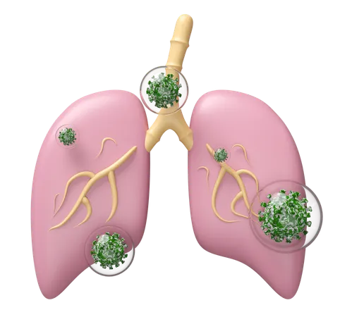 Lung With Virus  3D Icon