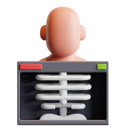 Lungs Xray  3D Illustration