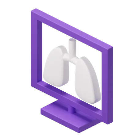 Lungs Xray  3D Illustration