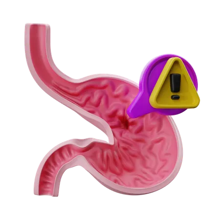 Anzeichen eines Magengeschwürs.  3D Icon