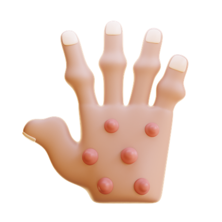 Nodules rhumatoïdes  3D Icon