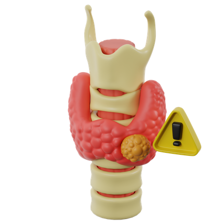 Nódulos tiroideos y cáncer  3D Icon
