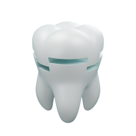 Obturação dentária 1  3D Icon