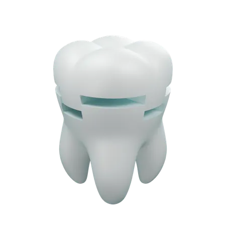 Obturação dentária 1  3D Icon