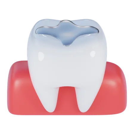 Obturação dentária  3D Icon