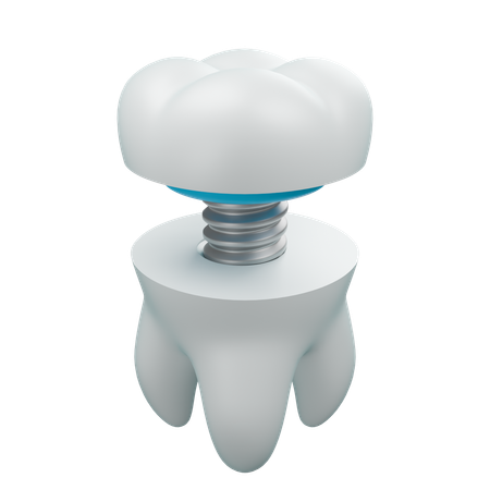 Obturação dentária 2  3D Icon