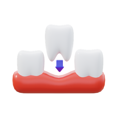 Obturação dentária  3D Icon