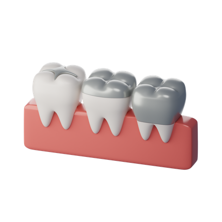 Remplissage des dents  3D Icon