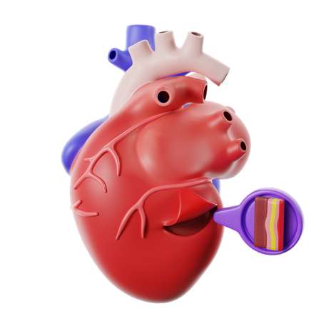 Of Heart Disease Pericarditis  3D Icon