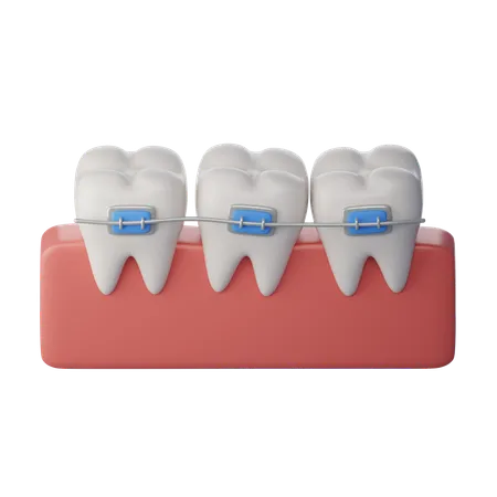 Orthodontics  3D Icon