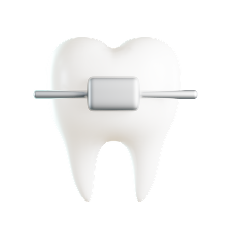 Orthodontics 3D Illustration