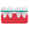 3d orthodontics illustration