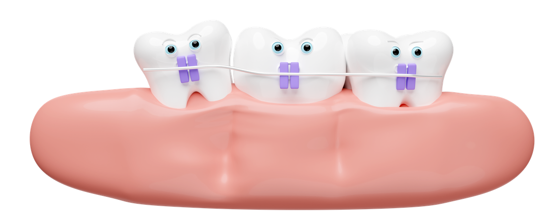 Orthodontics  3D Illustration