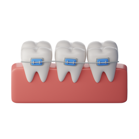 Orthodontie  3D Icon