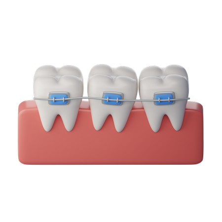Orthodontie  3D Icon
