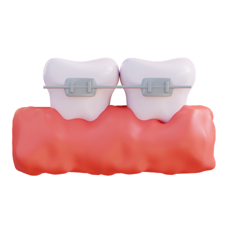 Orthodontie  3D Icon