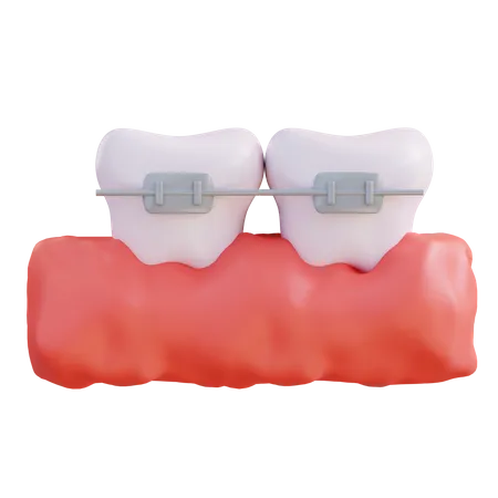 Illustration 3 D Du Port Dun Appareil Dentaire 3D Icon